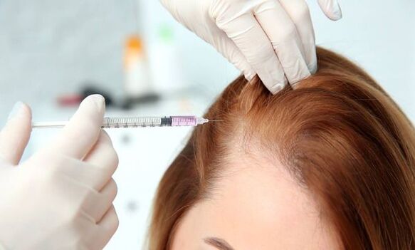 Mesotherapie gegen Haarausfall