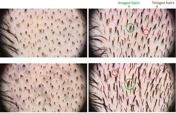 Phototrichogramm