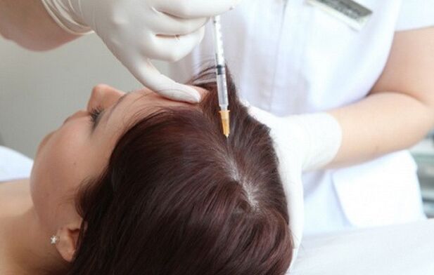 Mesotherapie zur Behandlung von weiblicher Alopezie