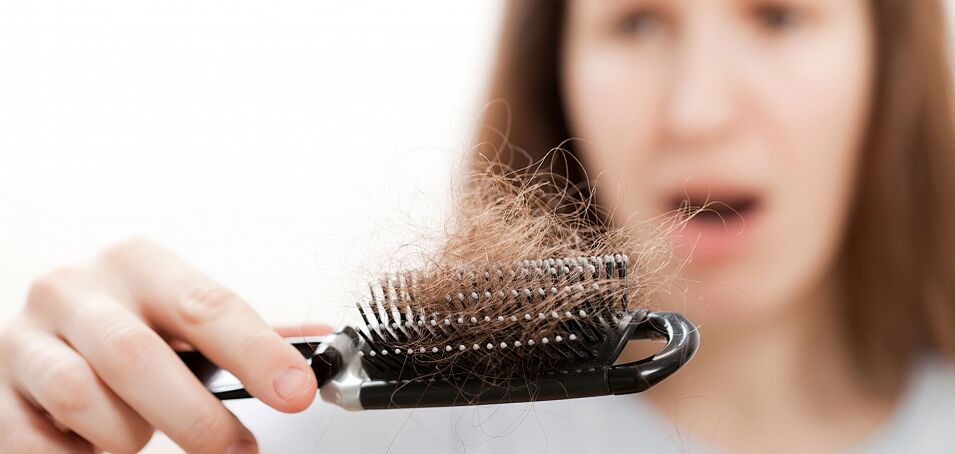 Haarausfall bei Frauen.
